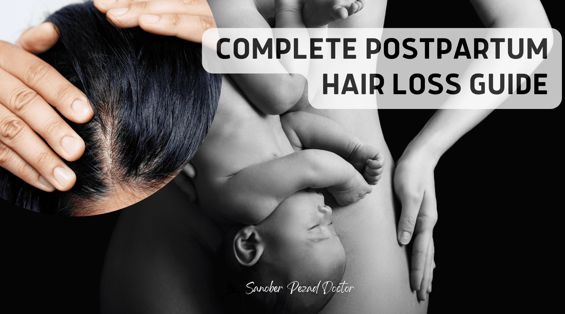 Postpartum Hair Loss: How I Reversed My Shedding Naturally by a Dermatologist